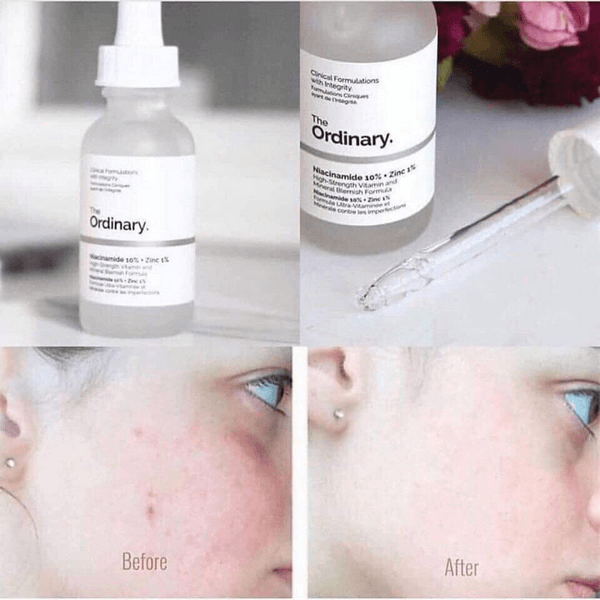 Serum The Ordinary 30ml Niacinamide 10% + Zinc 1%