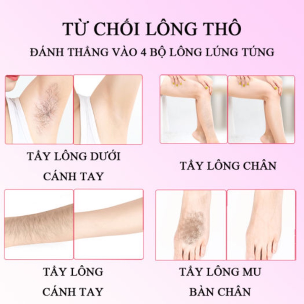 Tẩy lông Veet 100ml - Sensitive (xanh dương)
