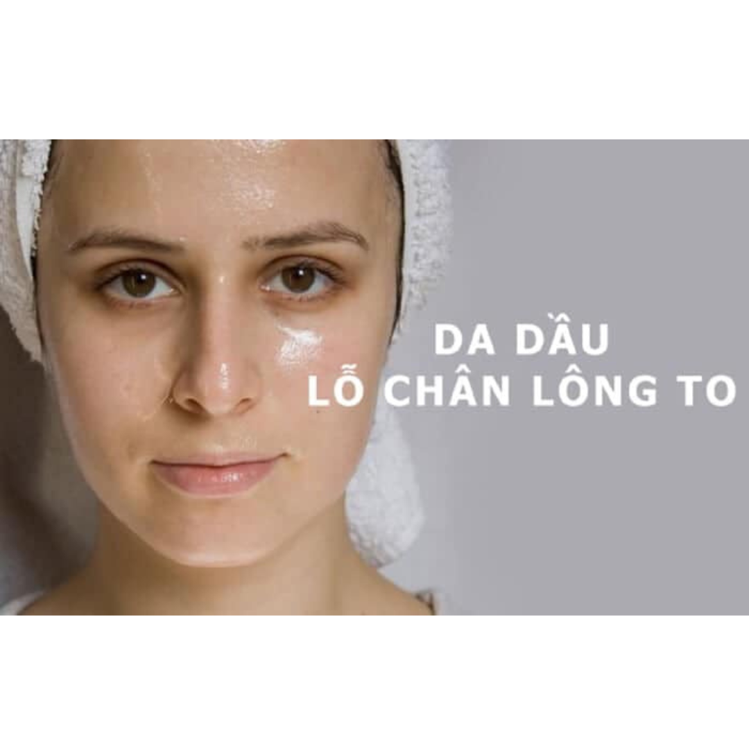 Các hoạt chất cần thiết chăm sóc da dầu, lỗ chân lông to Các hoạt chất cần thiết chăm sóc da dầu, lỗ chân lông to