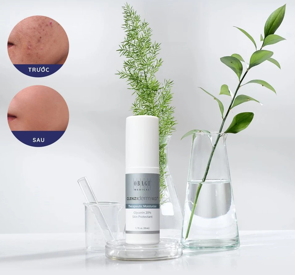 Kem dưỡng dành riêng cho da dầu, mụn Obagi Clenziderm Therapeeutic Moisturizer Kem dưỡng dành riêng cho da dầu, mụn Obagi Clenziderm Therapeeutic Moisturizer