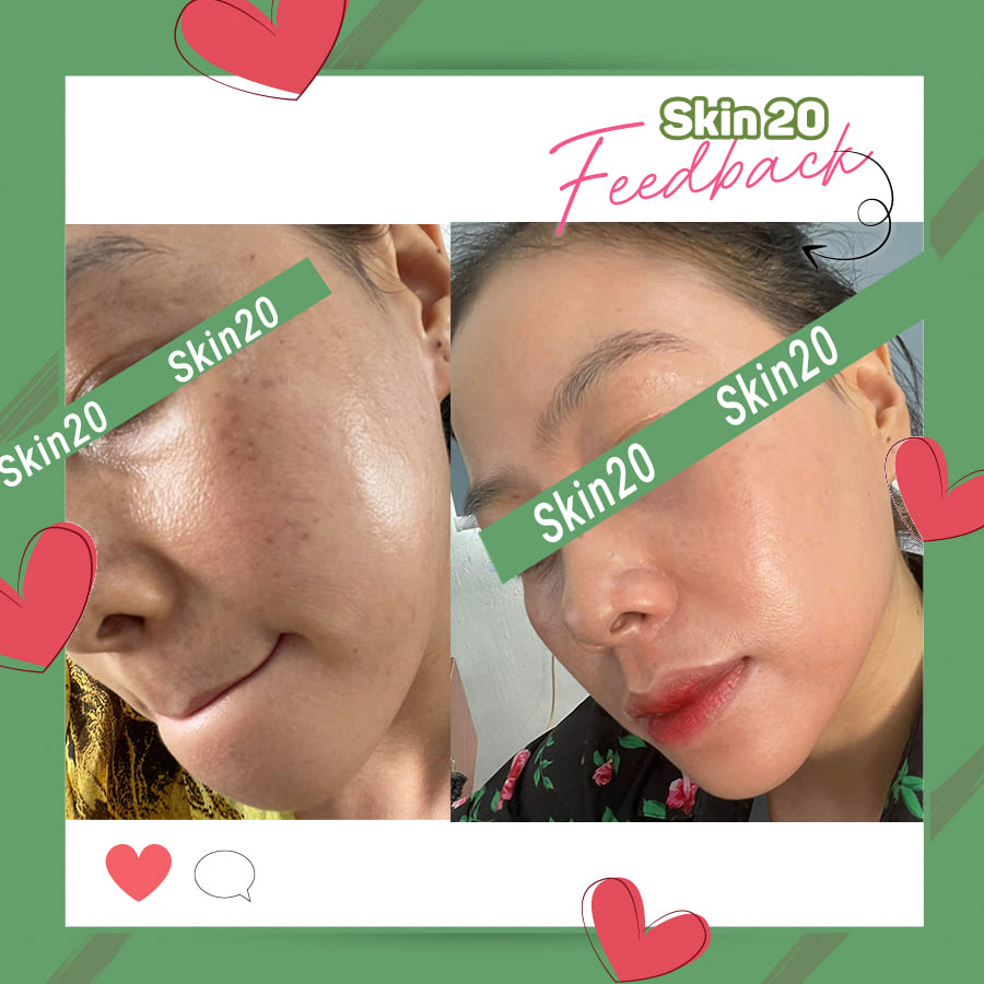 Serum chống oxy hóa, làm sáng đều màu da Obagi Professional C Serum 15% - 30ml