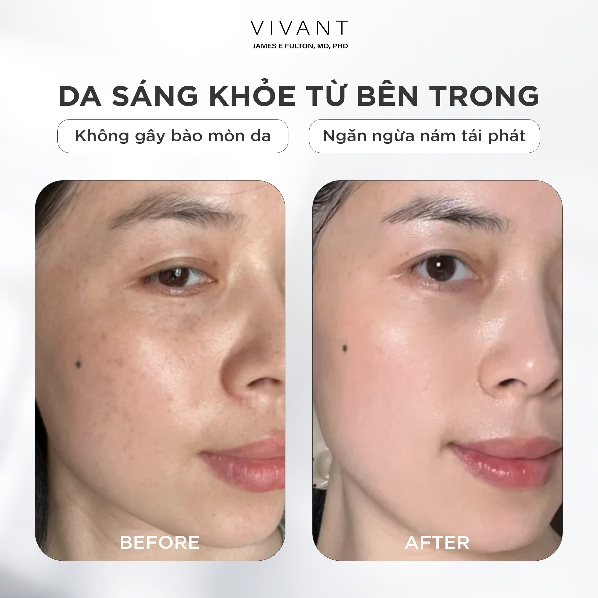 Tinh chất giảm nám, tàn nhang và cải thiện da sáng mịn Vivant Skincare True Tone 2.0 - 30ml