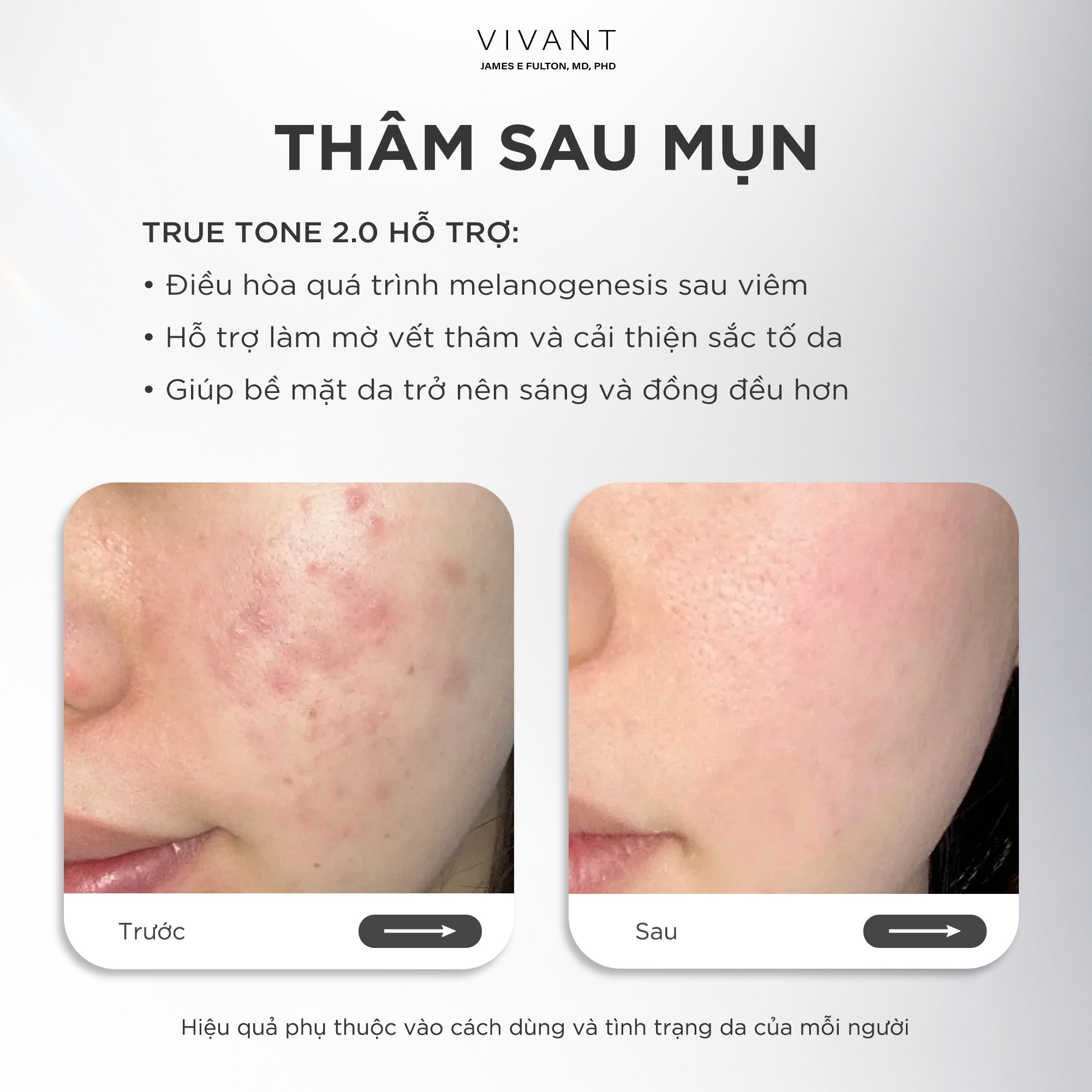 Tinh chất giảm nám, tàn nhang và cải thiện da sáng mịn Vivant Skincare True Tone 2.0 - 30ml