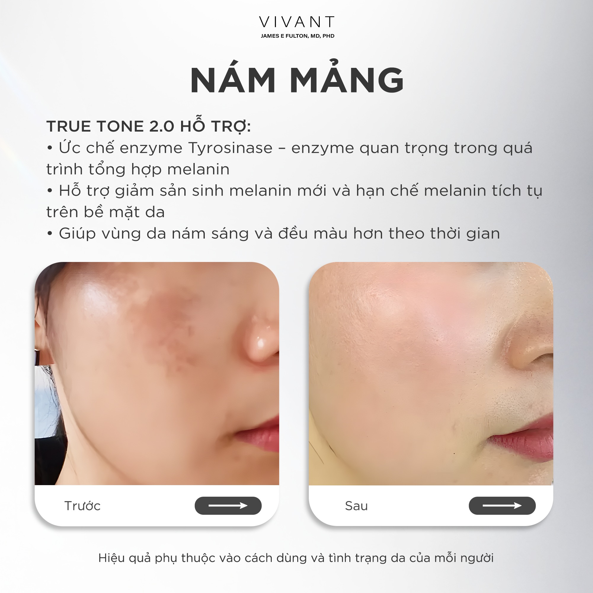 Tinh chất giảm nám, tàn nhang và cải thiện da sáng mịn Vivant Skincare True Tone 2.0 - 30ml