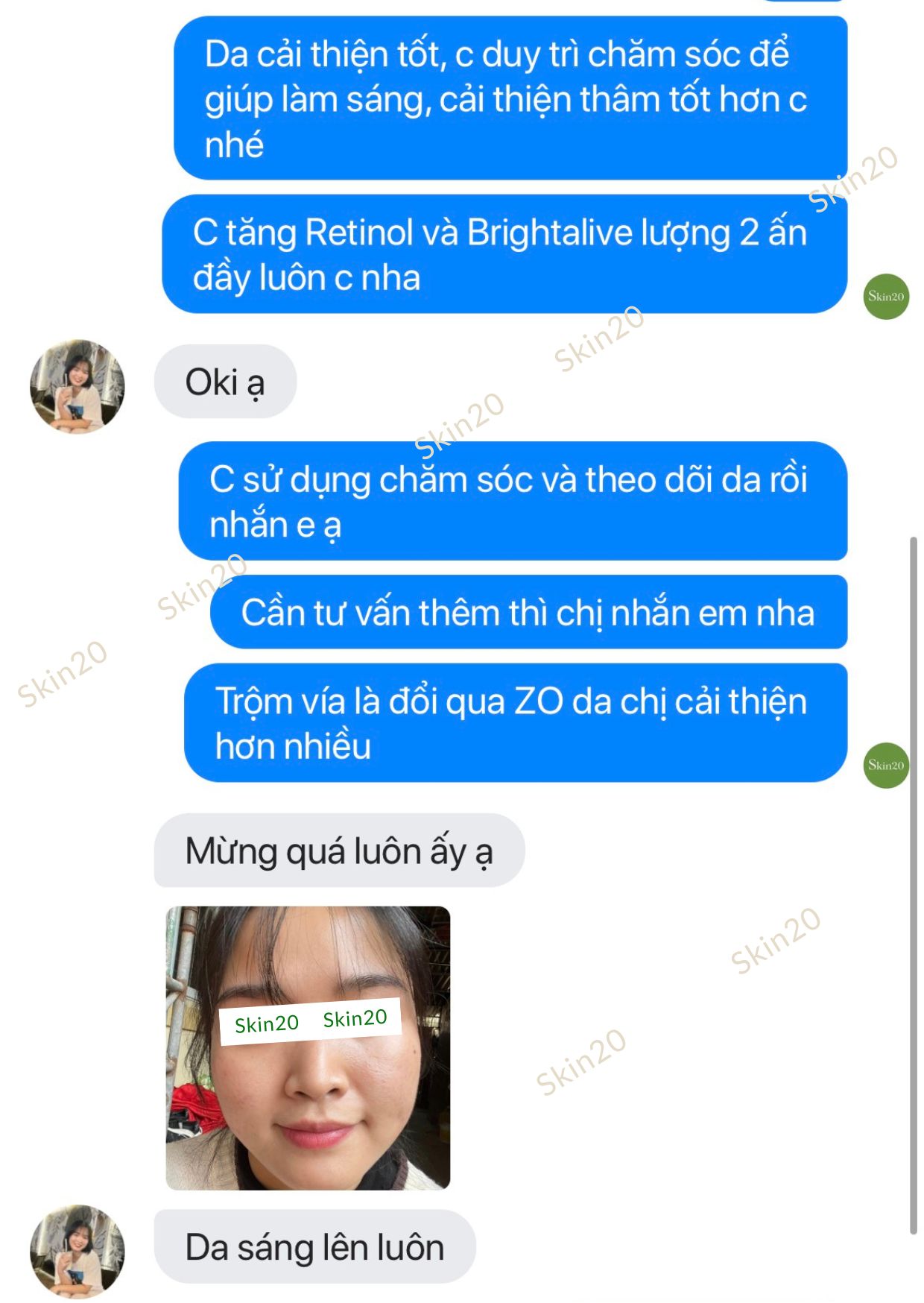 Kem làm sáng da ZO Skin Health Retinol Skin Brightener 0.5% - 50ml