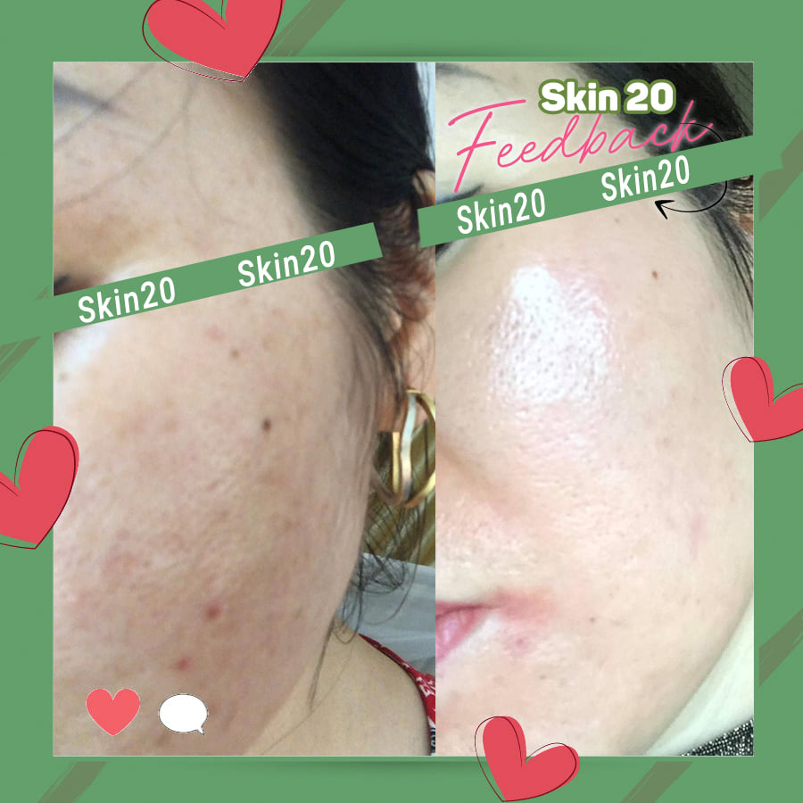 Tinh chất cấp nước phục hồi da Obagi Daily Hydro Drops