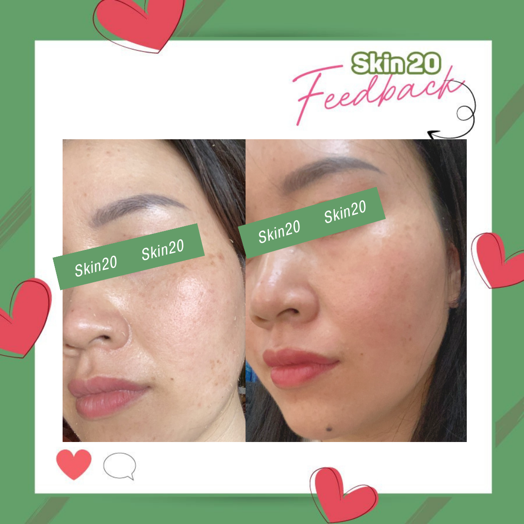 Serum chống oxy hóa, làm sáng đều màu da Obagi Professional C Serum 10% - 30ml