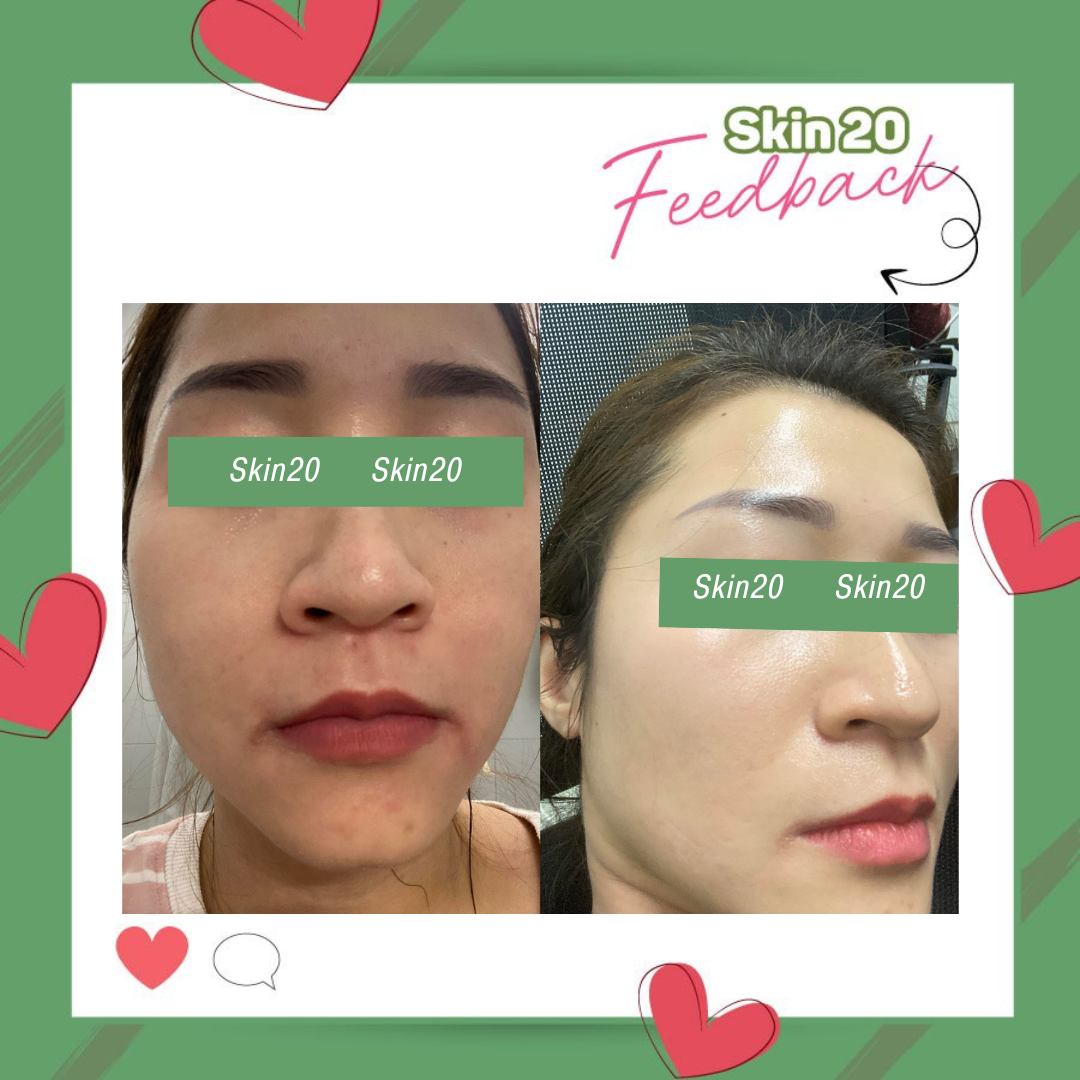Kem trị sạm nám, dưỡng trắng da Obagi Nuderm Blend Fx (số 5) - 57g