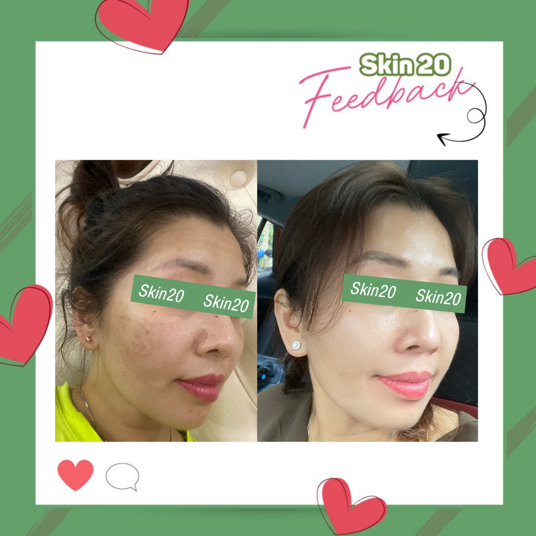 Serum chống oxy hóa, làm sáng đều màu da Obagi Professional C Serum 15% - 30ml