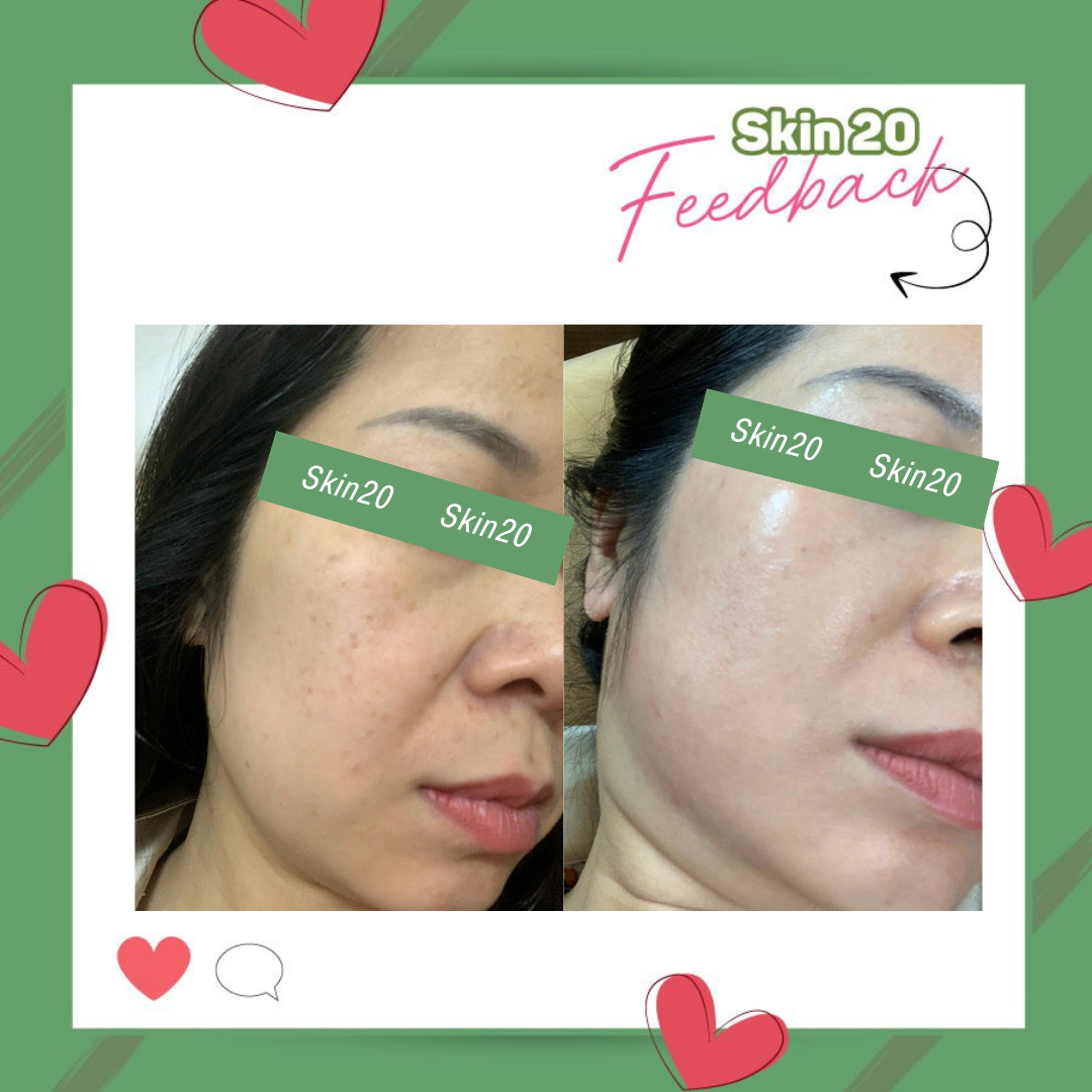 Kem đặc trị nám ZO Skin Health Pigment Control Creme - 80g