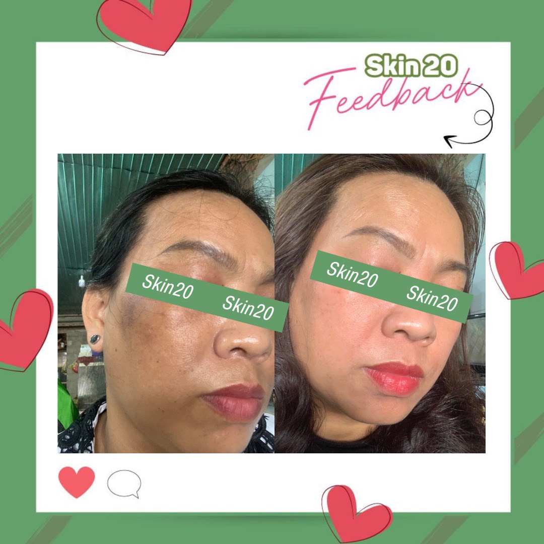 Serum chống oxy hóa, làm sáng đều màu da Obagi Professional C Serum 20% - 30ml