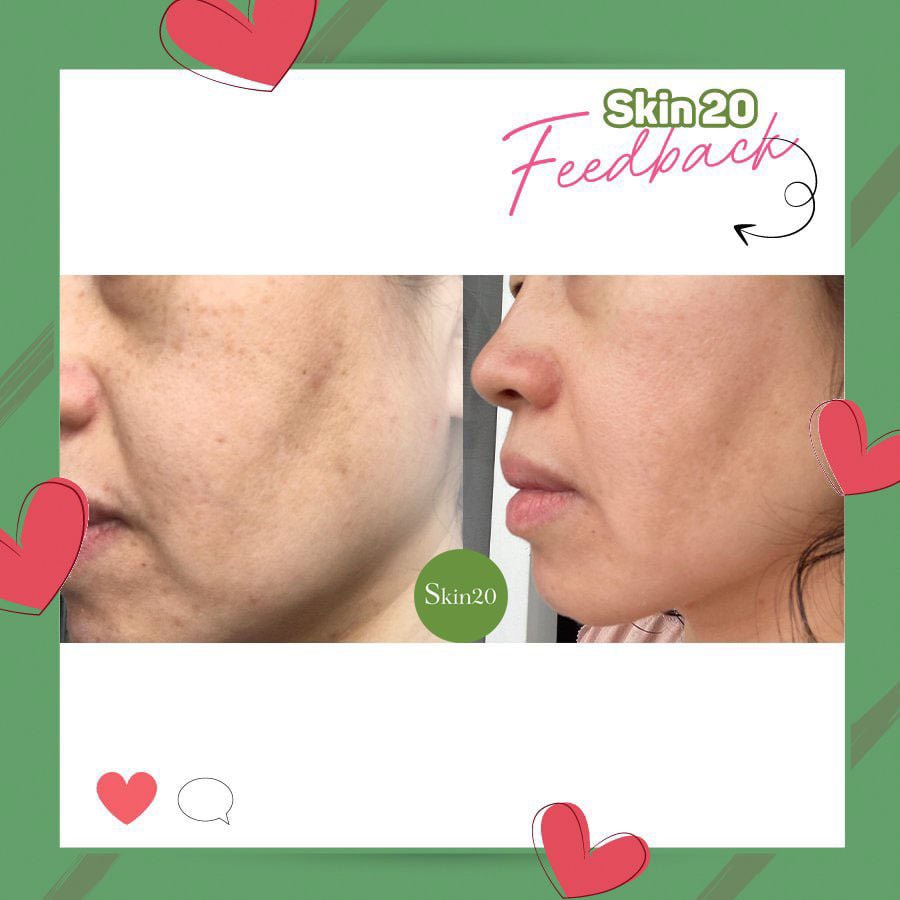 Serum chống oxy hóa, làm sáng đều màu da Obagi Professional C Serum 20% - 30ml