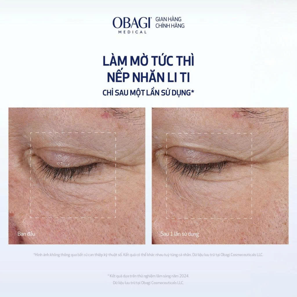 Tinh Chất Chuyên Sâu Làm Mờ Nếp Nhăn OBAGI Elastiderm Advanced Filler Concentrate - 20ml