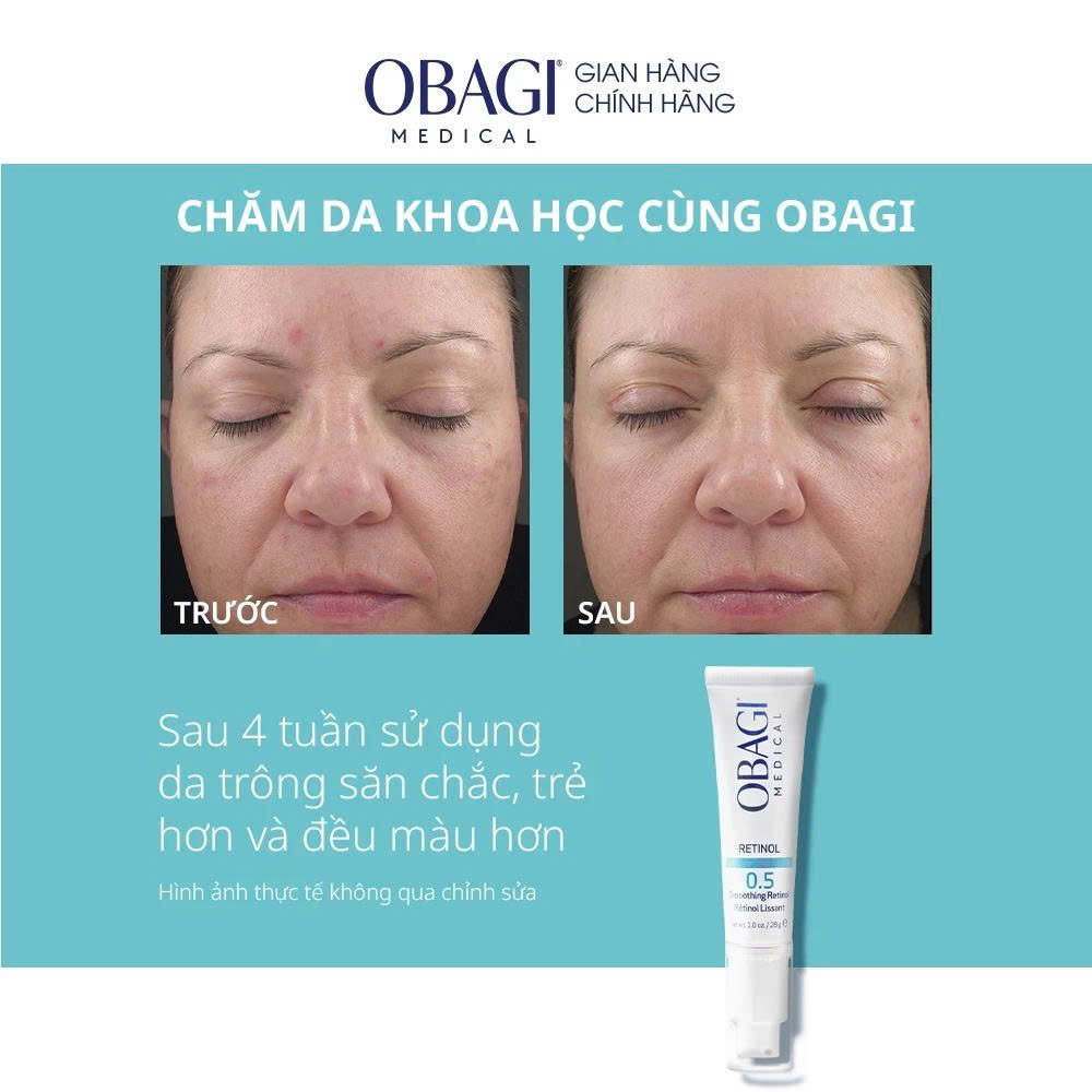 Kem chống lão hóa Obagi 360 Retinol 0.5 - 28g