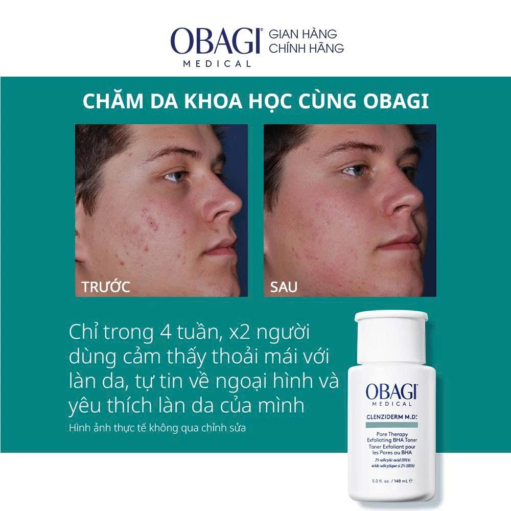 Dung dịch tẩy da chết Obagi Pore Therapy (BHA) - 148ml