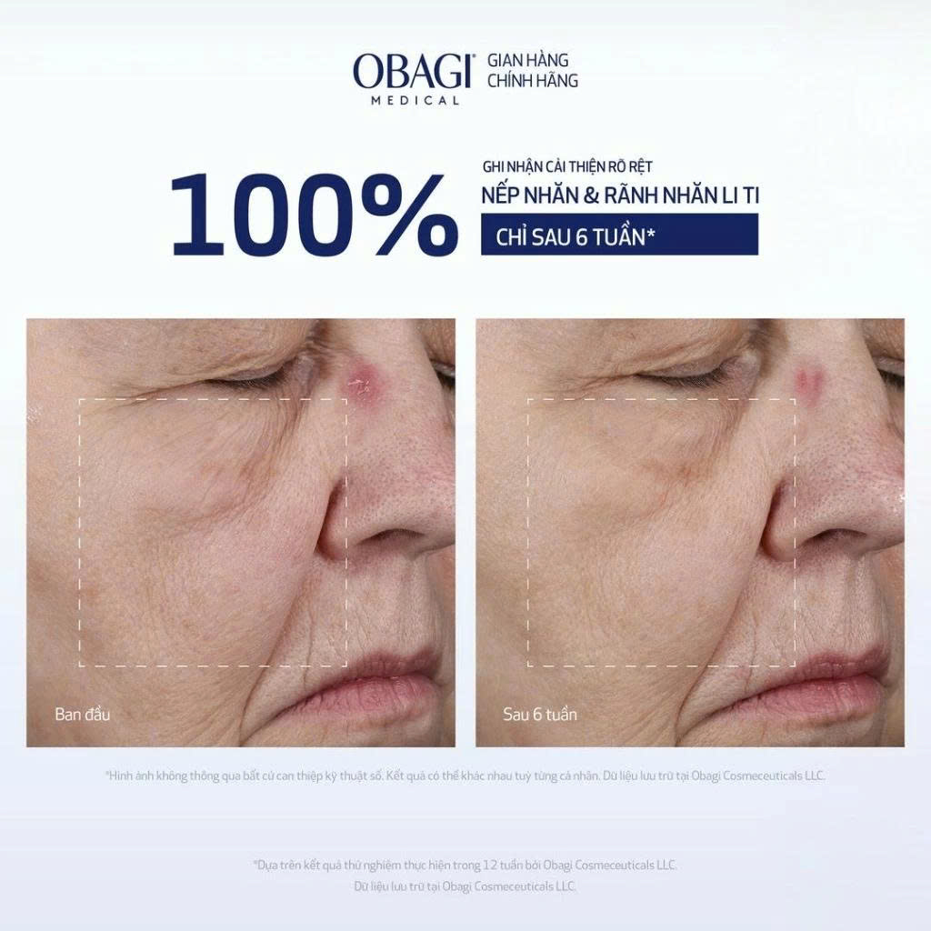 Kem Dưỡng Chuyên Sâu Làm Mờ Nếp Nhăn OBAGI Elastiderm Lift up & Sculpt Facial Cream - 50ml