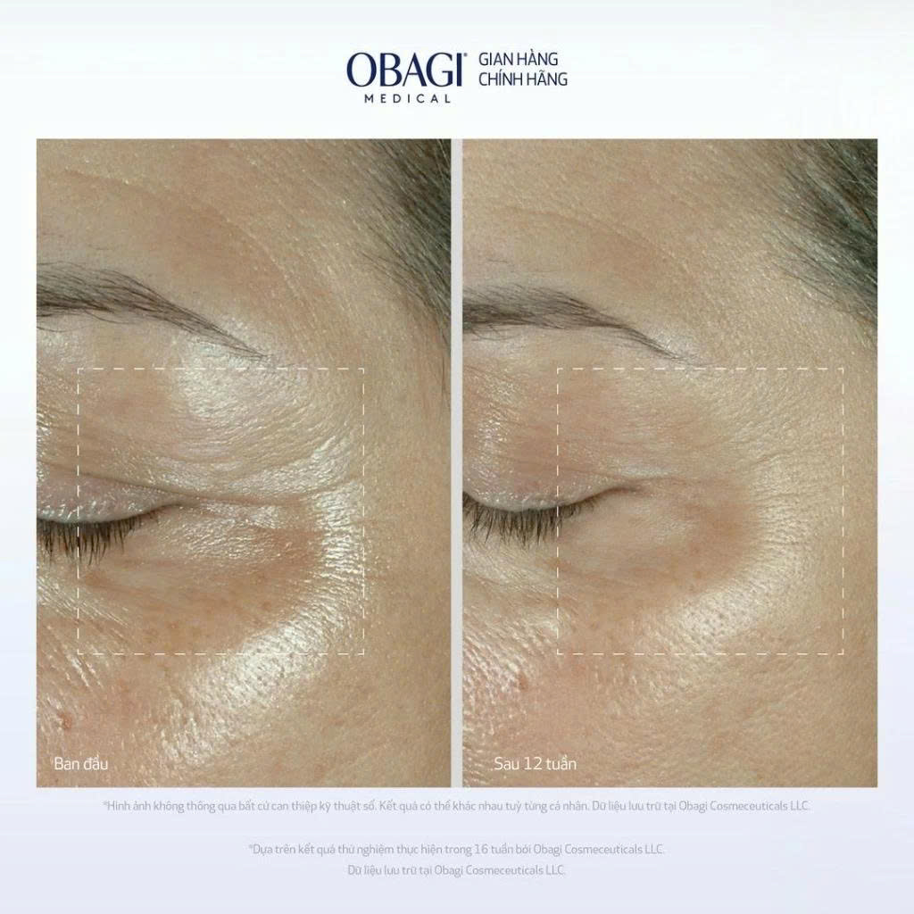 Kem dưỡng giảm nhăn, trẻ hóa da vùng mắt Obagi Elastiderm Eye Cream - 15g