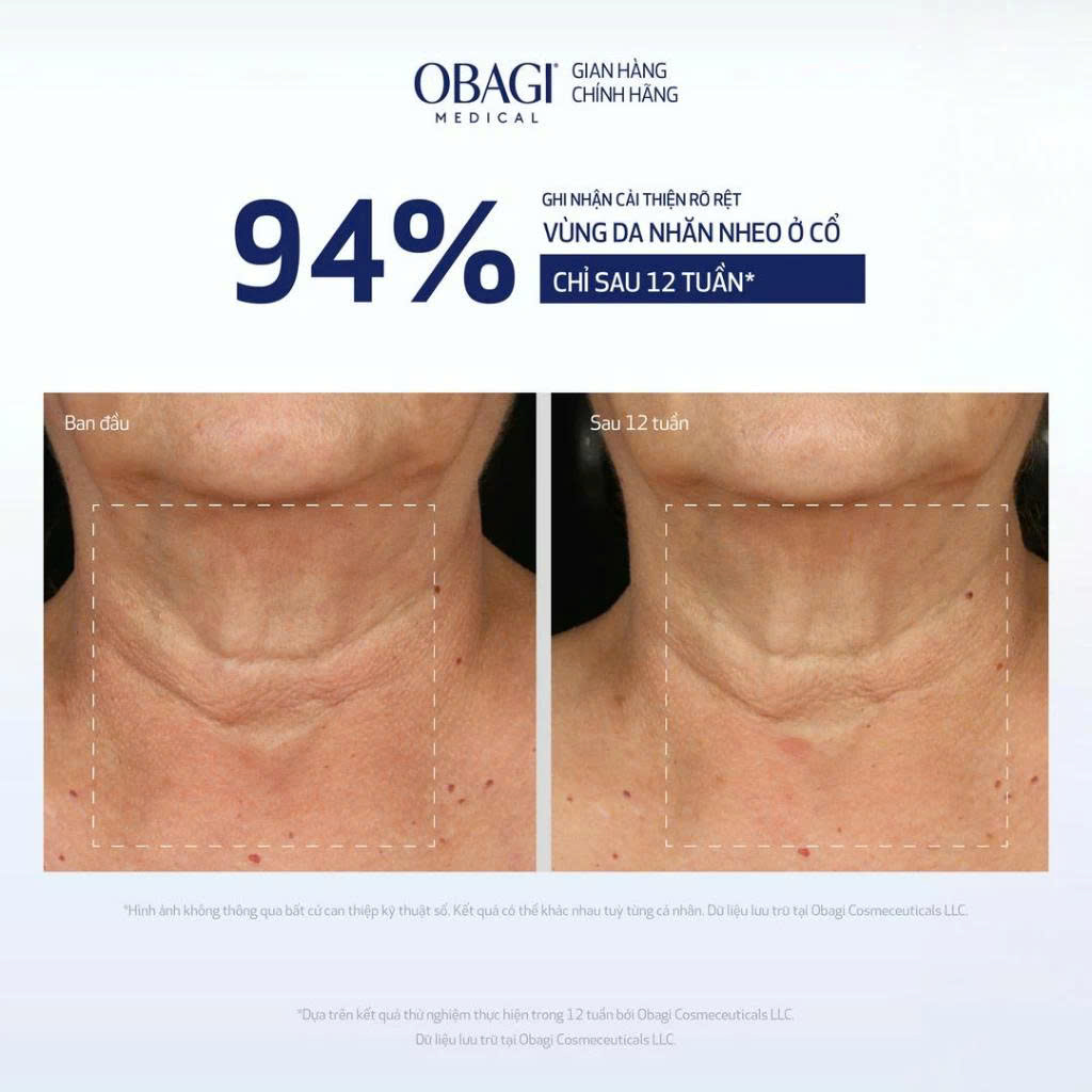 Tinh chất trẻ hóa da cổ Obagi Elastiderm Neck and Décolleté Concentrate