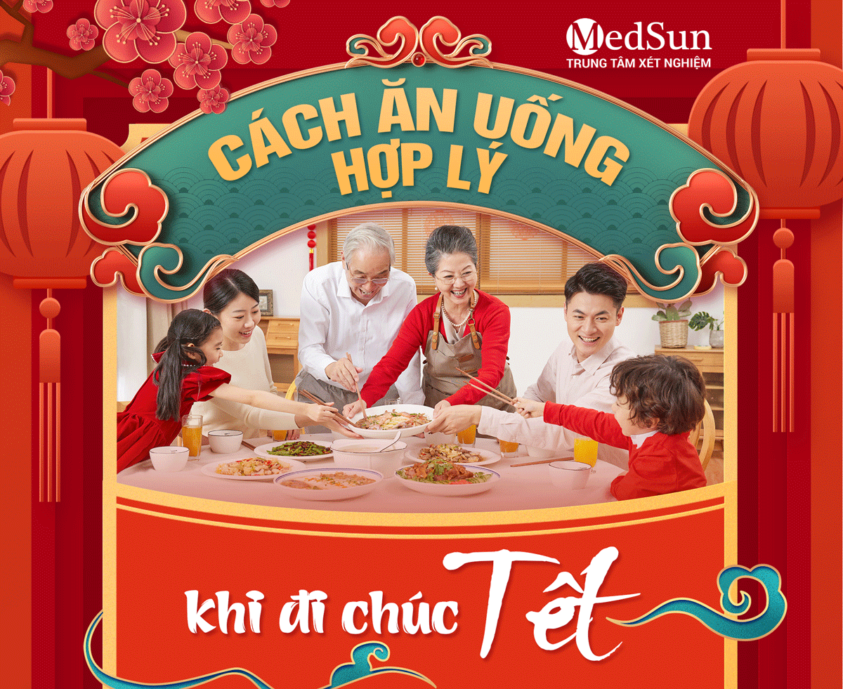 Mùng 2 – Mùng 3 Tết: Cách ăn uống hợp lý khi đi chúc Tết để không mệt, không đầy bụng