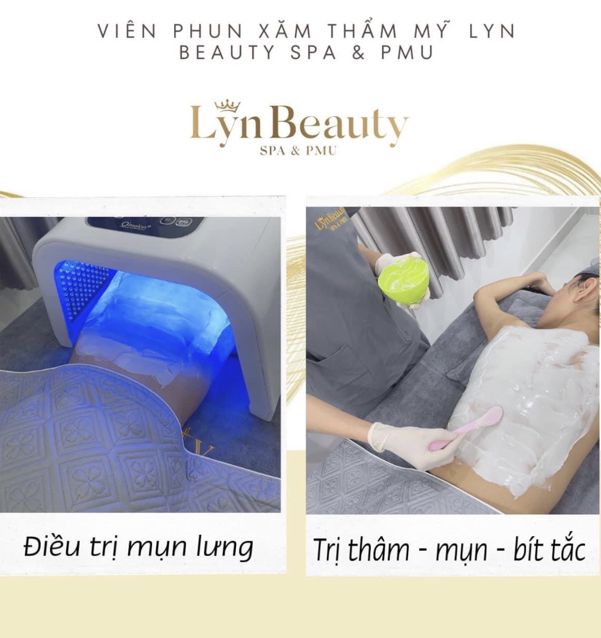 Điều Trị Mụn Lưng