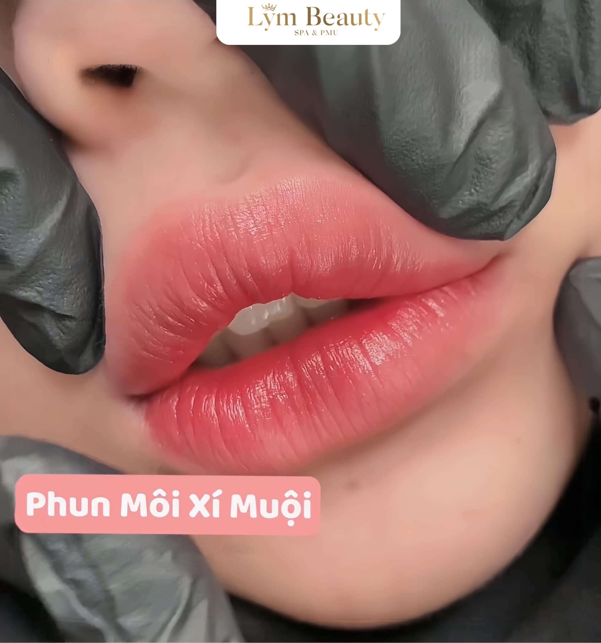 Phun Môi Collagen