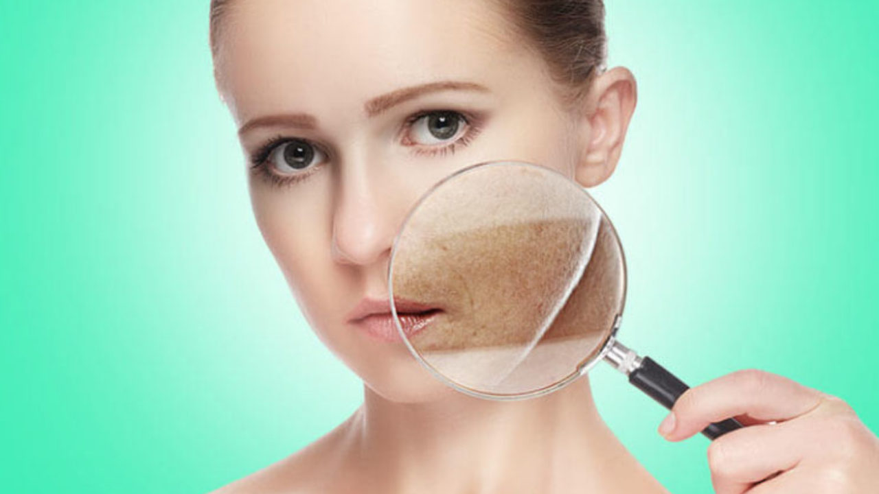 DỊ ỨNG MỸ PHẨM