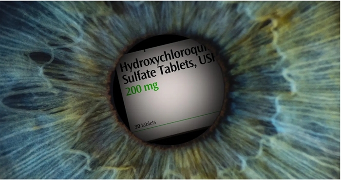BỆNH VÕNG MẠC DO HYDROXYCHLOROQUINE
