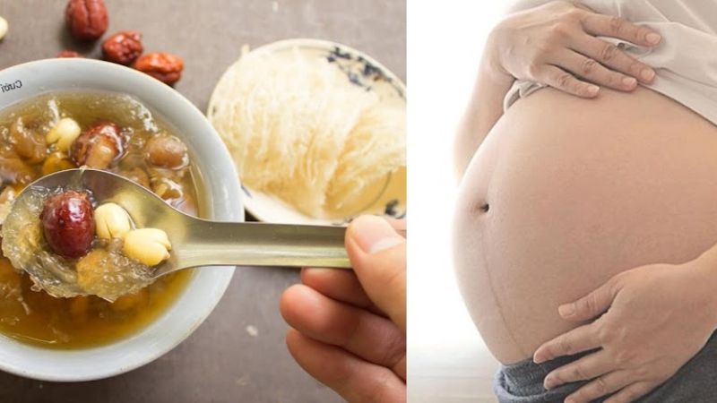 ĂN YẾN KHI MANG THAI – NHỮNG THẮC MẮC THƯỜNG GẶP