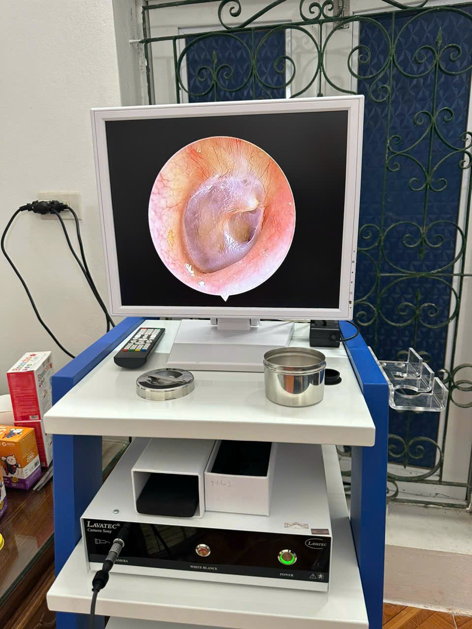 Thiết bị nội soi Tai Mũi Họng