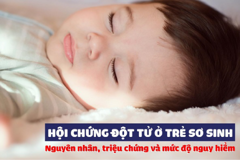 Giảm nguy cơ hội chứng đột tử ở trẻ sơ sinh (SIDS)