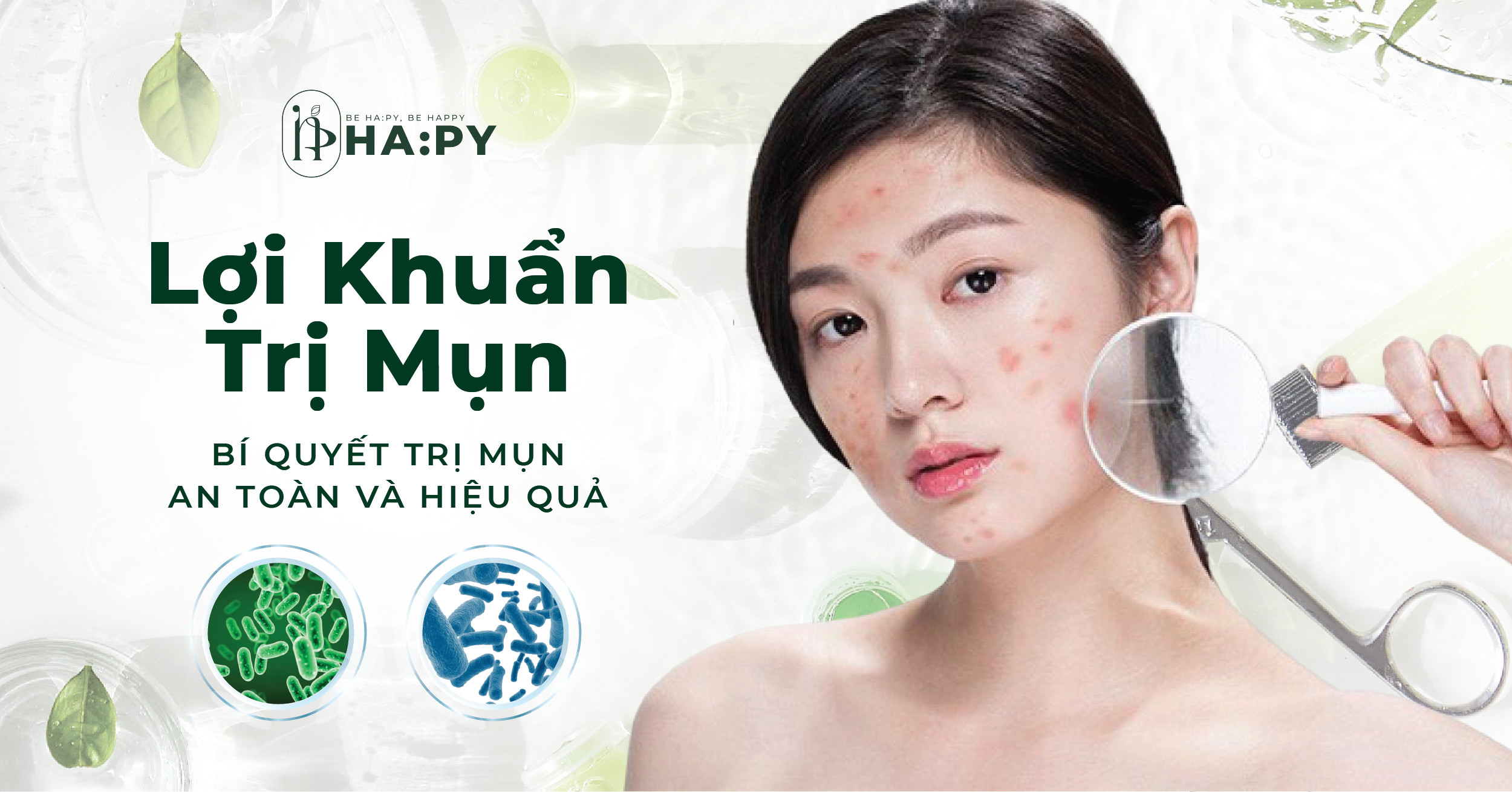 Lợi khuẩn trị mụn - Bí quyết “tạm biệt mụn” an toàn và hiệu quả