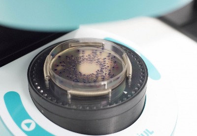 Máy đếm khuẩn lạc tự động và Đo vòng vô khuẩn model: SphereFlash®, IUL-Tây Ban Nha