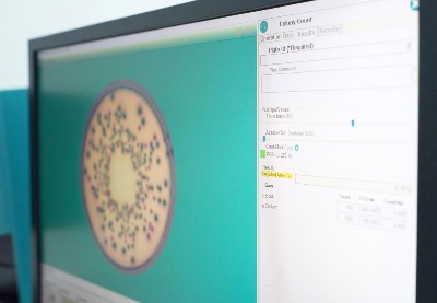 Máy đếm khuẩn lạc tự động và Đo vòng vô khuẩn model: SphereFlash®, IUL-Tây Ban Nha