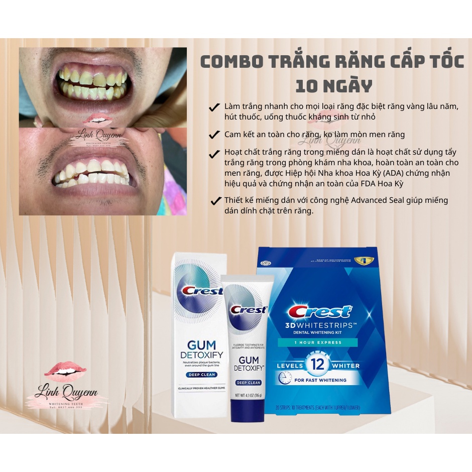 Miếng Dán Trắng Răng Crest 3D White Của Mỹ - Làm Trắng Răng Tại Nhà Tẩy Trắng Răng Cấp Tốc Combo 7 gói