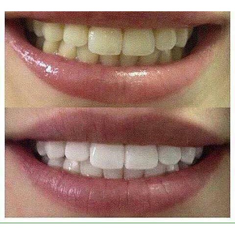 KEM ĐÁNH RĂNG CREST GUM DETOXIFY SIÊU TRẮNG THAN HOẠT TÍNH LÀM TRẮNG RĂNG CHUYÊN SÂU