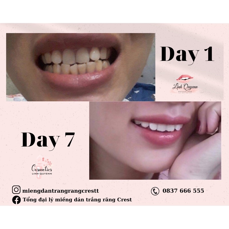 Kem đánh răng Crest 3D White Advanced Tripple Whitening Làm Trắng Răng Cấp Tốc