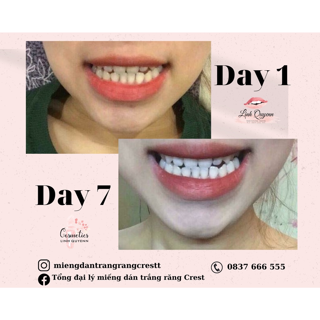 Miếng Dán Trắng Răng Crest 3D White Của Mỹ - Làm Trắng Răng Tại Nhà Tẩy Trắng Răng Cấp Tốc Combo 7 gói