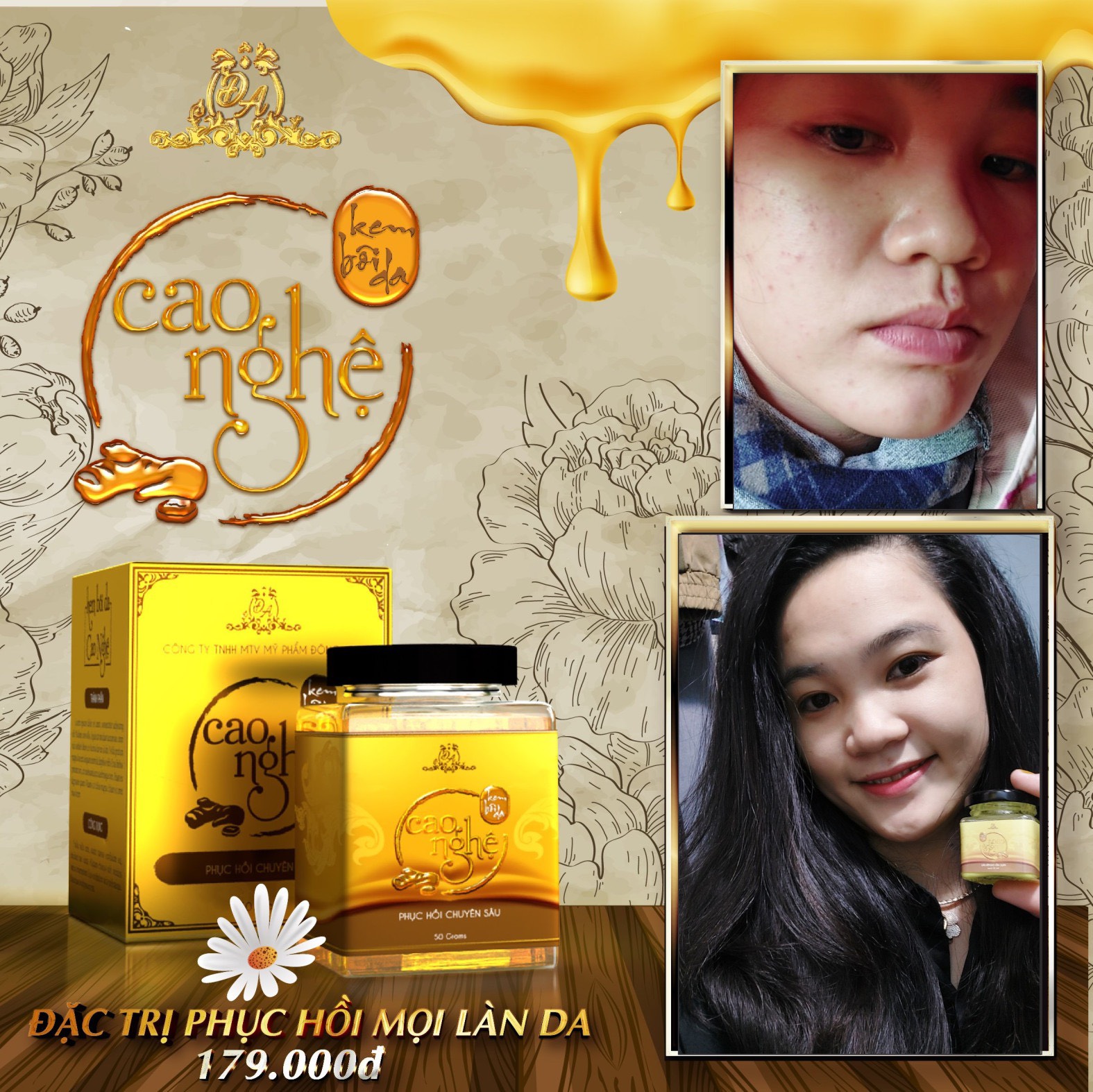 Cao Nghệ Ủ Đêm Phục Hồi Da