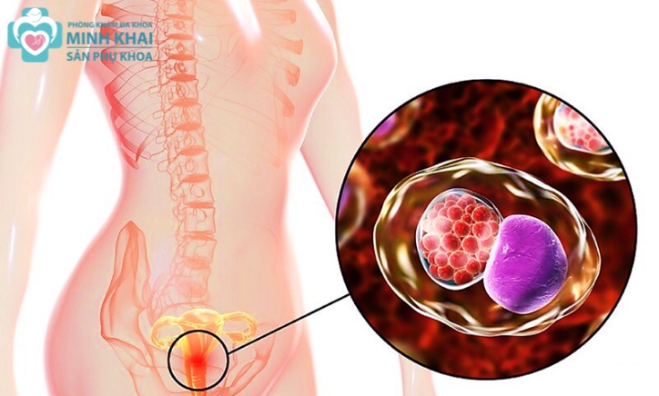 Bệnh Xã Hội Là Gì? Dấu Hiệu, Tác Hại Và Cách Phòng Tránh Hiệu Quả
