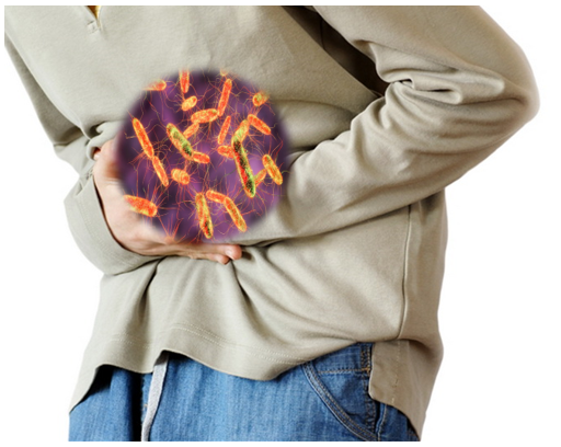 Vi khuẩn Salmonella tác nhân gây ngộ độc thực phẩm