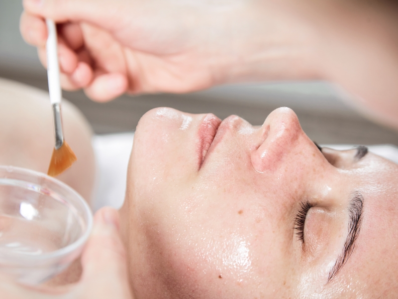 Tất tần tật về Peel trị nám