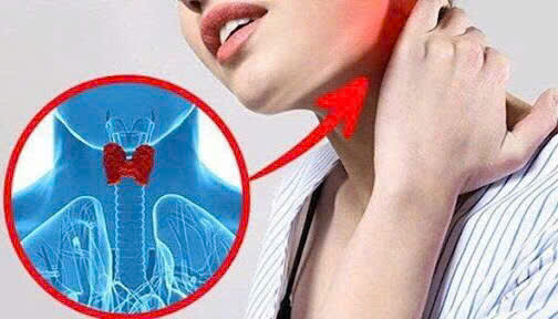 5 Biểu Hiện Sớm Ung Thư Tuyến Giáp Dễ Bỏ Qua – Đừng Chủ Quan!