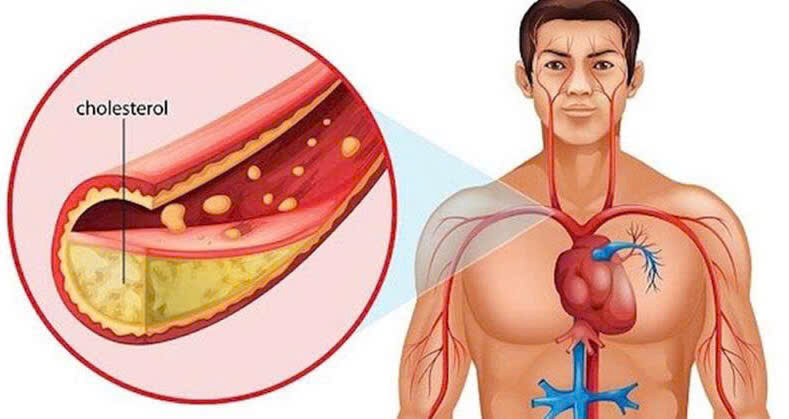 Top 7 Loại Đồ Uống Giúp Hạ Cholesterol Và Đường Huyết Tự Nhiên, Hiệu Quả