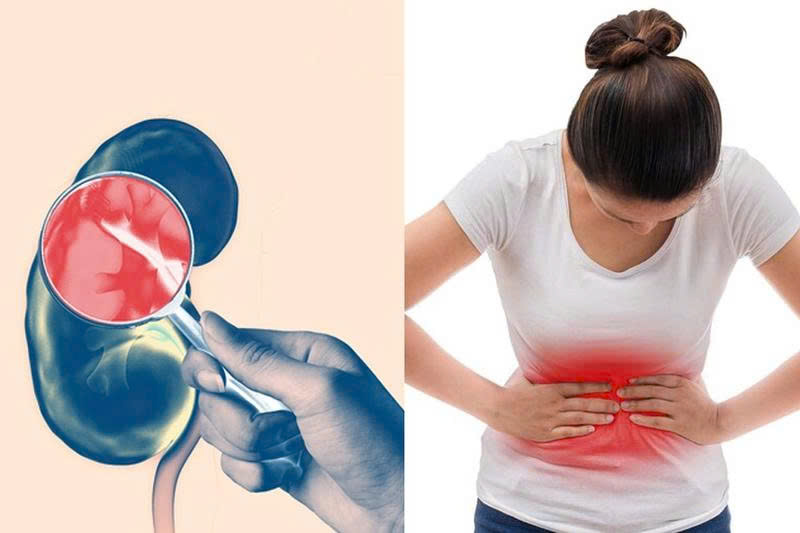 3 Dấu Hiệu Cảnh Báo Suy Thận Giai Đoạn Cuối Bạn Không Nên Bỏ Qua