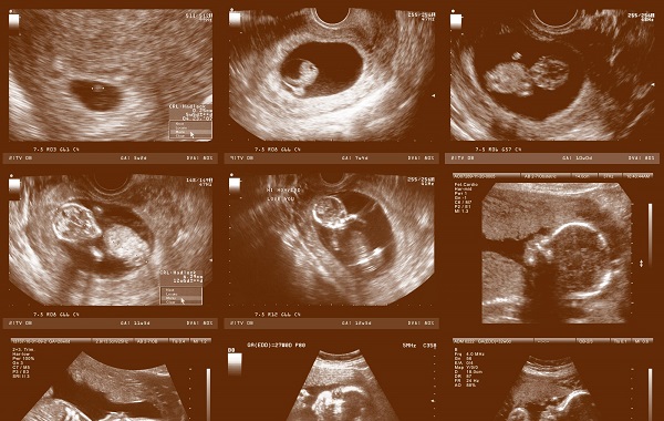  Chuẩn bị đồ khi đi khám thai