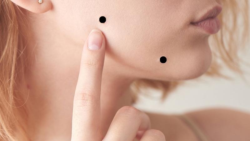Vị trí nốt ruồi trên mặt nữ