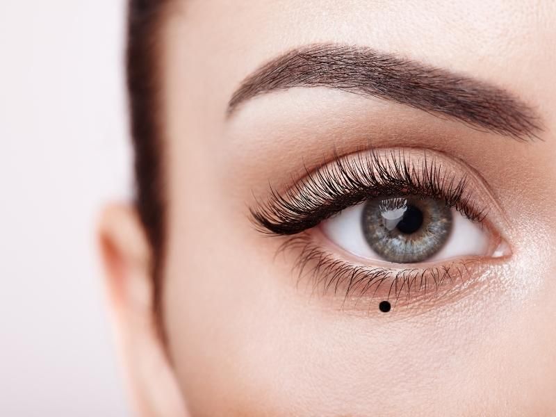 Vị trí nốt ruồi trên mặt nữ