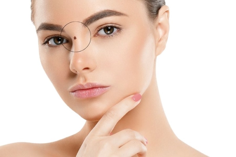 vị trí nốt ruồi trên mặt nữ