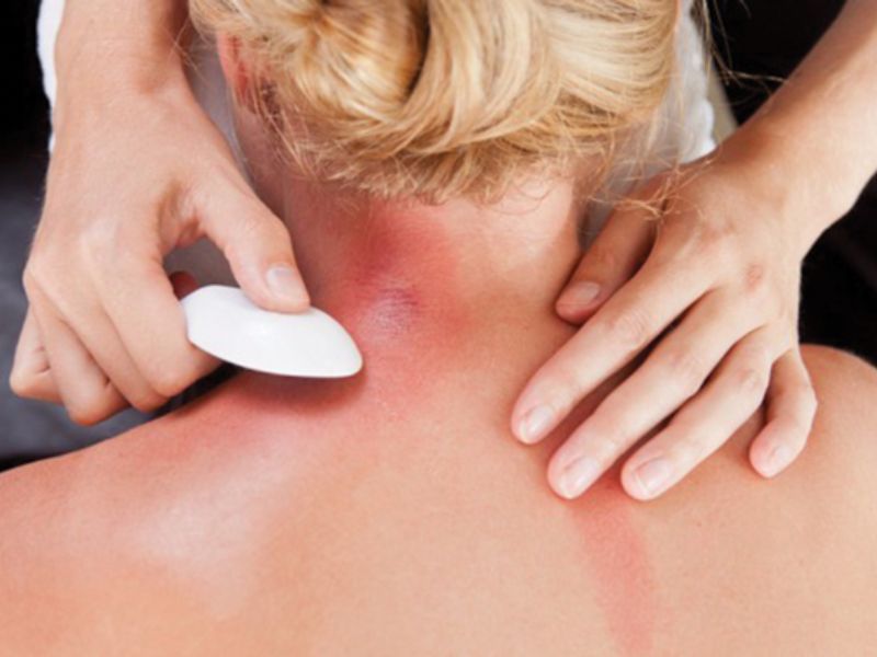 Đánh cảm bằng bạc giúp làm giảm các triệu chứng mệt mỏi nhanh chóng