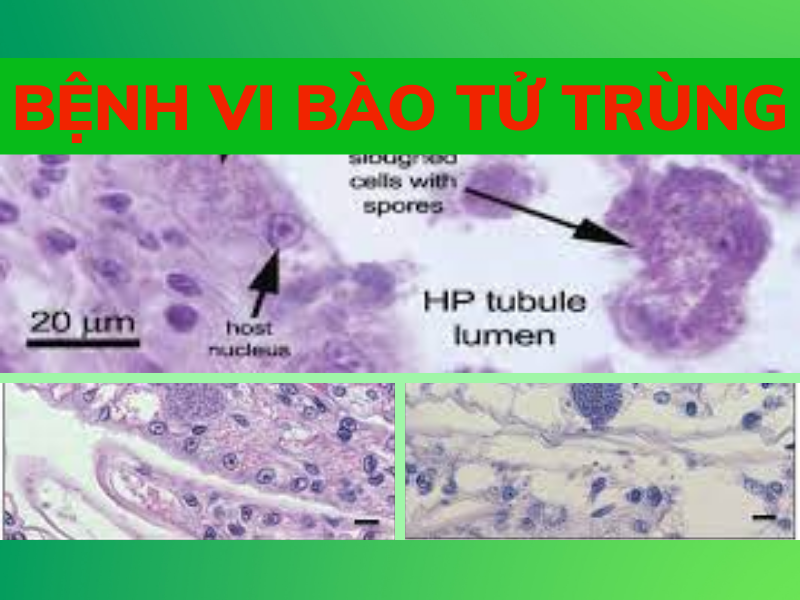 GIẢI PHÁP PHÒNG NGỪA BỆNH VI BÀO TỬ TRÙNG TRÊN TÔM (Microsporidian)